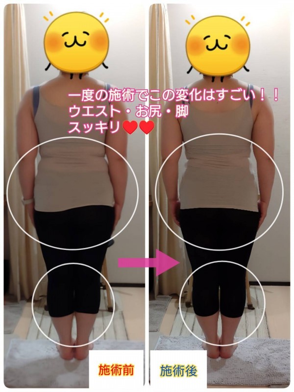 一度でも驚きの変化！！